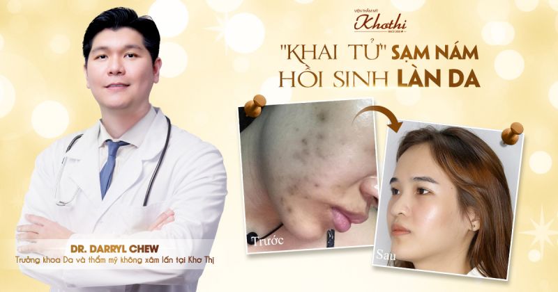 Điều trị nám
